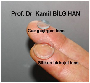 Gaz geçiren lens - silikon hidrojel lens